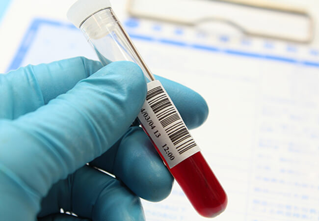 血液サンプル